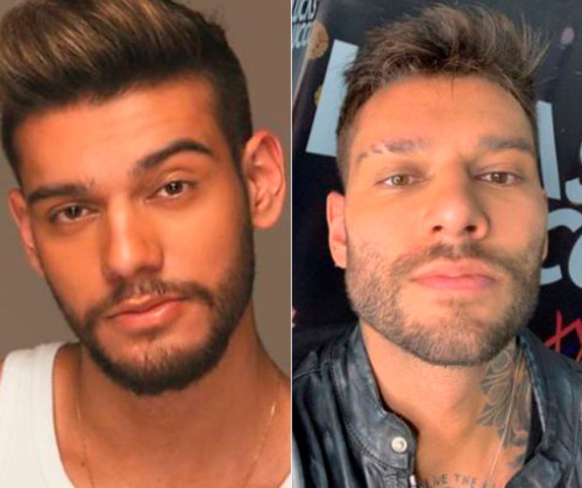 O que deu errado na harmonização facial de Lucas Lucco? - Prisma - R7 Keila Jimenez