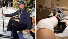 Internada, Luciana Gimenez relata dores fortes na perna após acidente grave em Aspen, nos EUA