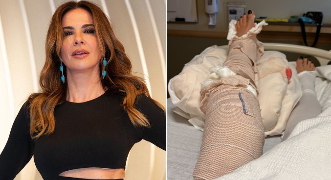 Após fraturar a perna, Luciana Gimenez mandou recado aos fãs na web
