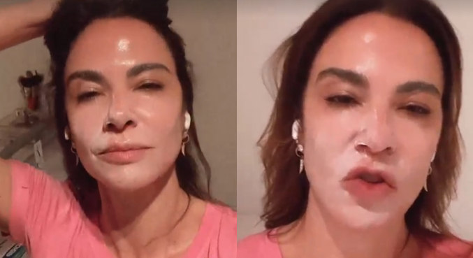 Luciana Gimenez mostrou rosto queimado após passar produto cosmético