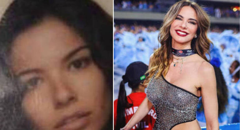 Luciana Gimenez, antes e depois, em montagem.