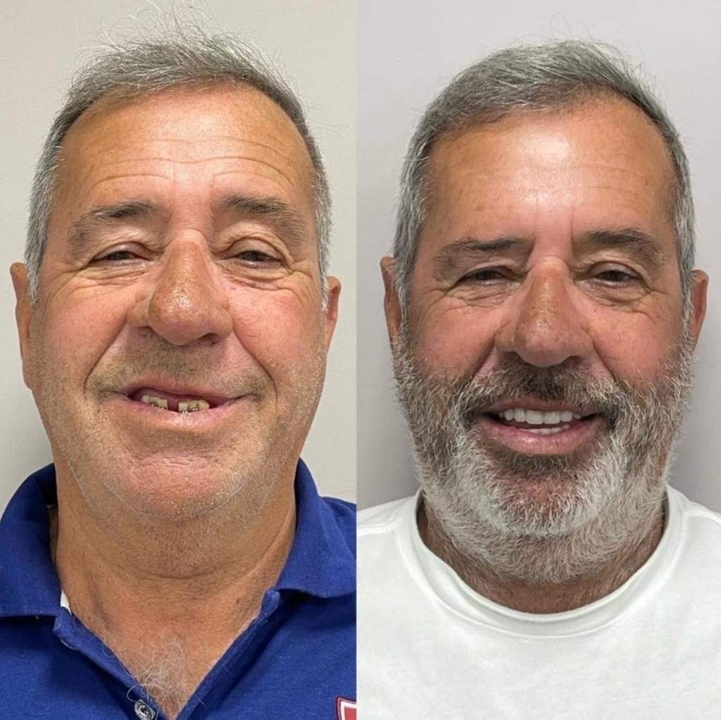 Antes e depois do pai de Ferrugem, Luiz Carlos
