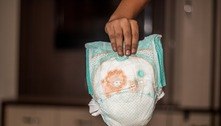 Mãe proíbe avós de trocarem fraldas do neto, para 'proteger privacidade do bebê' 
