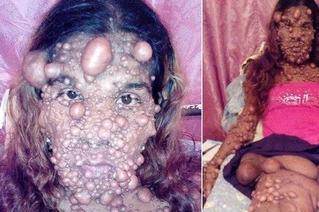 mãe bolhas após dar luz