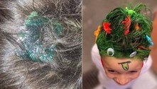 Mãe usa cola permanente para fazer 'penteado maluco' no filho: 'Solução é raspar'