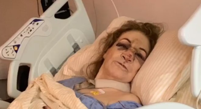 Mãe de Sônia Abrão sofreu queda grave após escorregar em tapete 