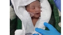 Vídeo: mulher descobre que estava grávida durante o parto no DF