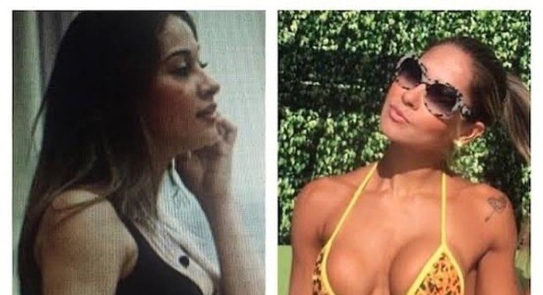 Influenciadora digital exibiu o antes e o depois em publicação nas redes sociais 