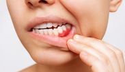 Sorriso impecável e livre de manchas: confira dicas para cuidar da sua boca (Sorria sem preocupações! Aprenda a evitar e tratar manchas nos dentes com facilidade!)