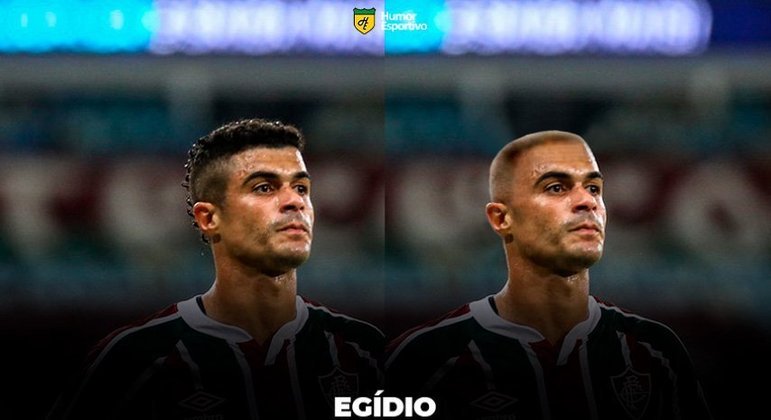 Sem cabelo! Montagens mostram como ficariam os jogadores carecas - Fotos -  R7 Esportes