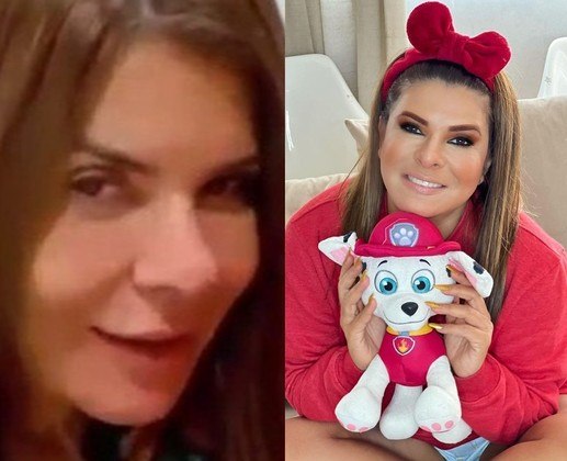 Mara Maravilha reverteu uma rinomodelação. O procedimento não cirúrgico muda o formato do nariz com a aplicação de ácido hialurônico. 