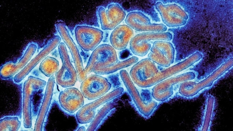 Pacientes infectados pelo vírus Marburg apresentam inicialmente febre, calafrios, dores de cabeça e musculares, mas o quadro evolui para vômito e diarreia, pele amarelada, inflamação no pâncreas, insuficiência hepática, delírios, hemorragia e disfunção de múltiplos órgãos