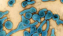 Gana confirma outra morte pelo vírus de Marburg, 'primo' do ebola