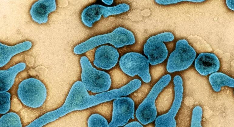 Ghana confirma dos muertes por virus de Marburg altamente contagioso