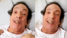 Marcos Oliveira, o Beiçola, se recupera de cirurgia em casa e pede dinheiro: 'Tenho que comer'