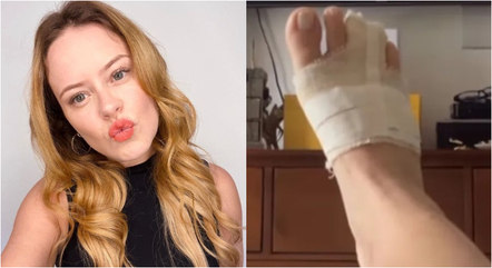 Mari Bridi quebrou o dedo do pé durante festa