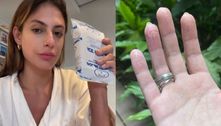 Mari Gonzalez queima a mão no babyliss: 'Não aguento de dor'