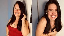 Mariana Bridi exibe o corpo pela primeira vez após passar por cirurgias plásticas