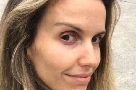 Mariana Ferrão filho doentinho