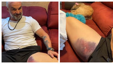 Mateus Carrieri sofre lesão na coxa após brincadeira: 'Deu ruim'