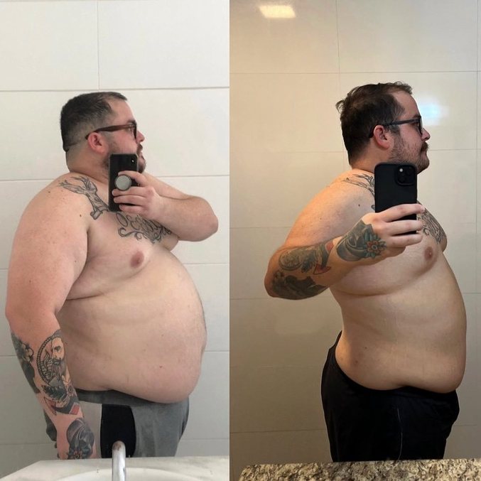 Matheus Granado chegou a pesar 150 kg e começou a ter problemas de saúde