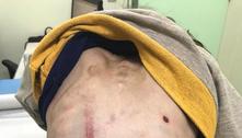 Mãe é investigada por suspeita de maus-tratos à filha de 7 anos