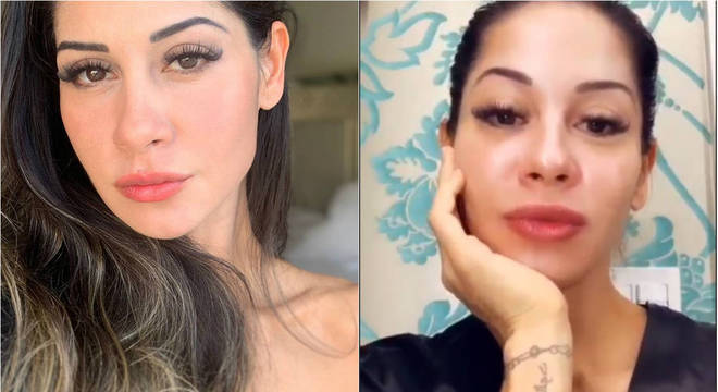 mayra-cardi-revela-que-fez-preenchimento-labial-e-botox-18062020144140969