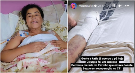 MC Katia se recupera após amputação de parte do pé