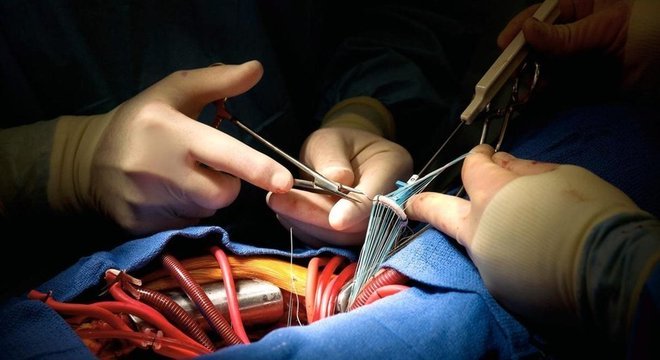 Curativo impresso em 3D seria costurado diretamente no coração