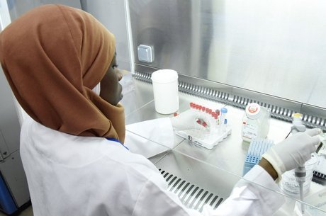 Instituto Pasteur, no Senegal, é uma das entidades preparadas para fazer diagnóstico da doença no continente