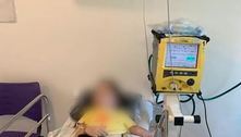 Após coma, menina que engoliu álcool em gel em SP tem alta, mas ainda sente dores 
