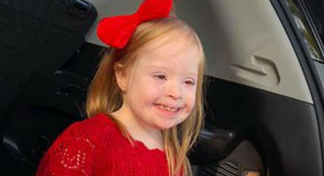 menina sindrome down