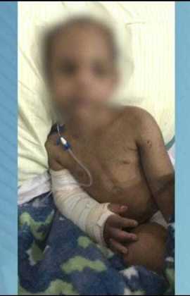 Uma criança de 4 anos deu entrada no hospital após ter sido espancada pelo padrasto e pela mãe por ter feito “bagunça”, em São Vicente, no litoral de São Paulo. O menino teve quatro costelas quebradas, entre outros ferimentos pelo corpo