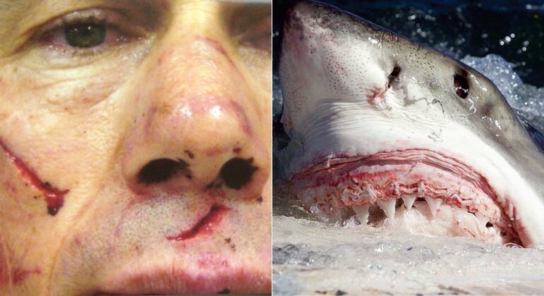 Mergulhador contou como é ser engolido por um tubarão-branco