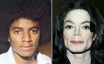 A mudança de aparência de Michael Jackson foi um dos aspectos mais polêmicos de sua vida. A lista de cirurgias plásticas a que o rei do pop se submeteu ao longo da vida é longa. Começa com uma rinoplastia — realizada nos anos 70, quando tinha 19 anos — e inclui enchimento nas bochechas, implantes no queixo, Botox e mudança no formato dos lábios. De acordo com pessoas próximas ao cantor, essa saga para mudar a fisionomia foi motivada pelo desejo de Michael de eliminar as semelhanças com o pai, o empresário Joseph Joe Jackson, que abusou dele na infância