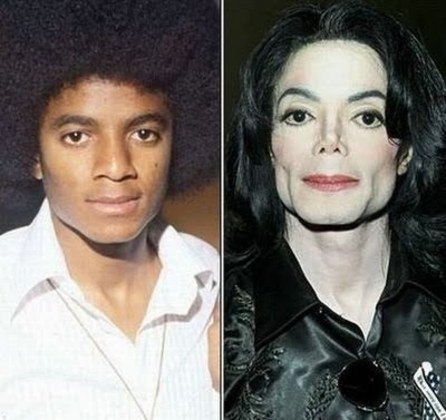 A mudança de aparência de Michael Jackson foi um dos aspectos mais polêmicos de sua vida. A lista de cirurgias plásticas a que o rei do pop se submeteu ao longo da vida é longa. Começa com uma rinoplastia — realizada nos anos 70, quando tinha 19 anos — e inclui enchimento nas bochechas, implantes no queixo, Botox e mudança no formato dos lábios. De acordo com pessoas próximas ao cantor, essa saga para mudar a fisionomia foi motivada pelo desejo de Michael de eliminar as semelhanças com o pai, o empresário Joseph Joe Jackson, que abusou dele na infância
