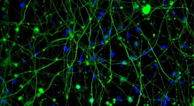 O minicérebro do jornalista Phil Ball