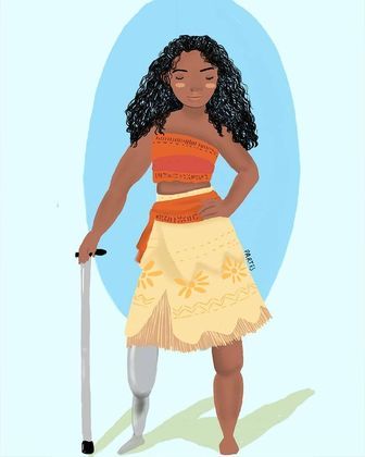 Já Moana tem uma bengala e uma prótese na perna esquerda