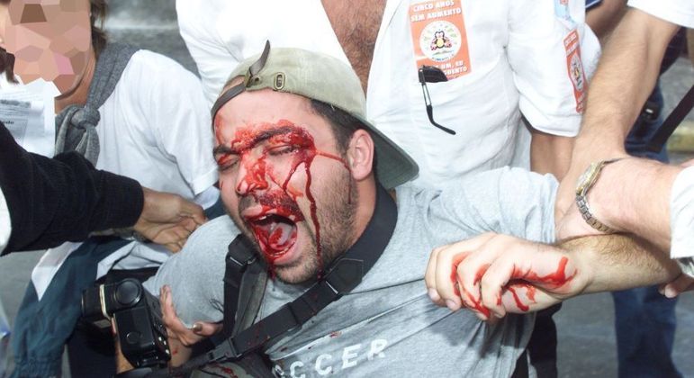 Alex Silveira é socorrido logo após ser atingido por bala de borracha 
