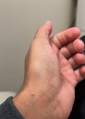 Advogado também teve outras lesões no corpo, mas menores e indolores