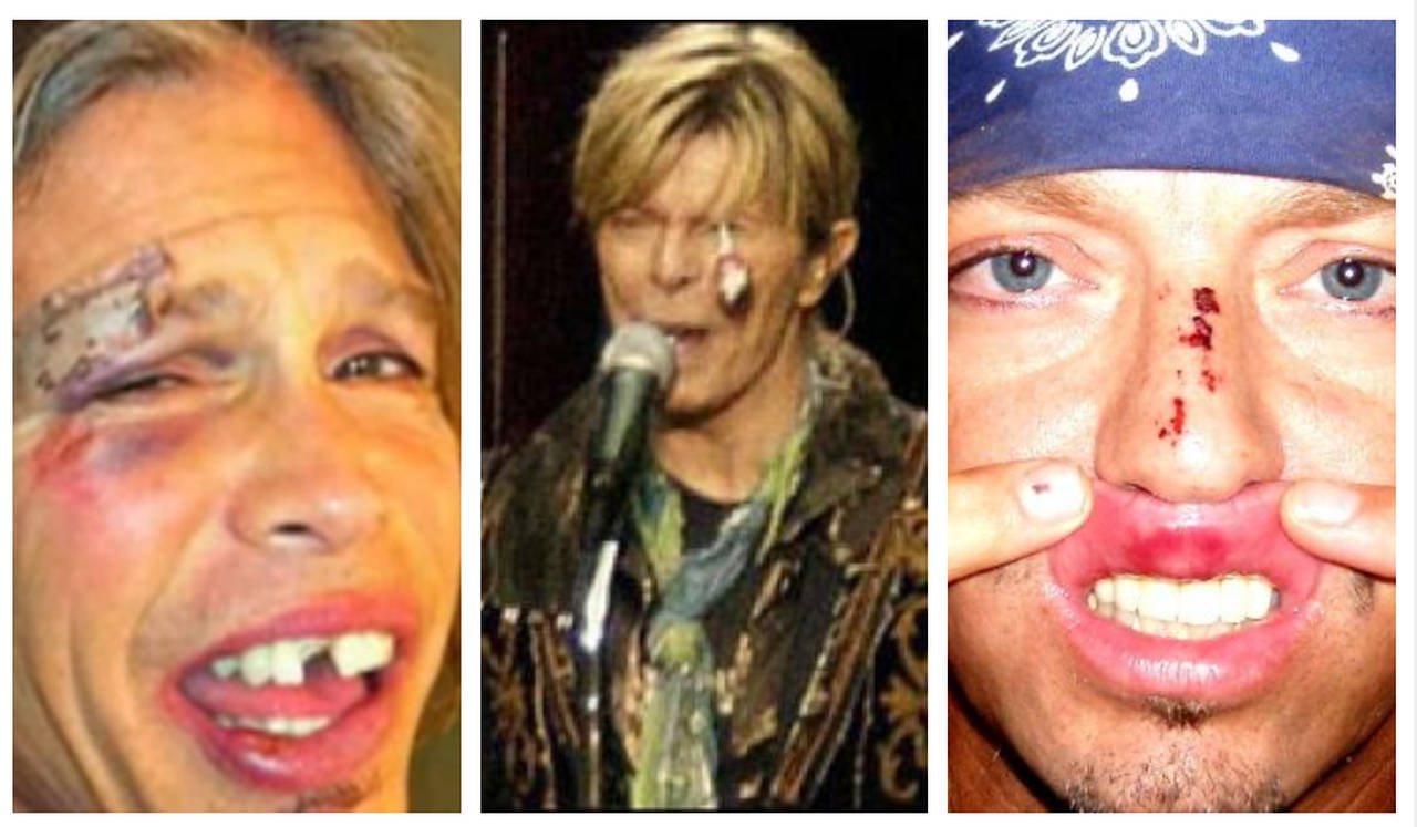 Pirulito No Olho E Lesao De Nadega Os Acidentes Bizarros Dos Musicos Fotos R7 Musica pirulito no olho e lesao de nadega os