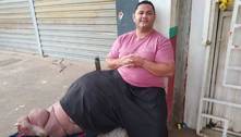 Morador do DF sofre com doença que o deixou com perna gigante