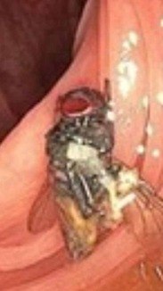 Médicos descobrem mosca intacta dentro do intestino de idoso