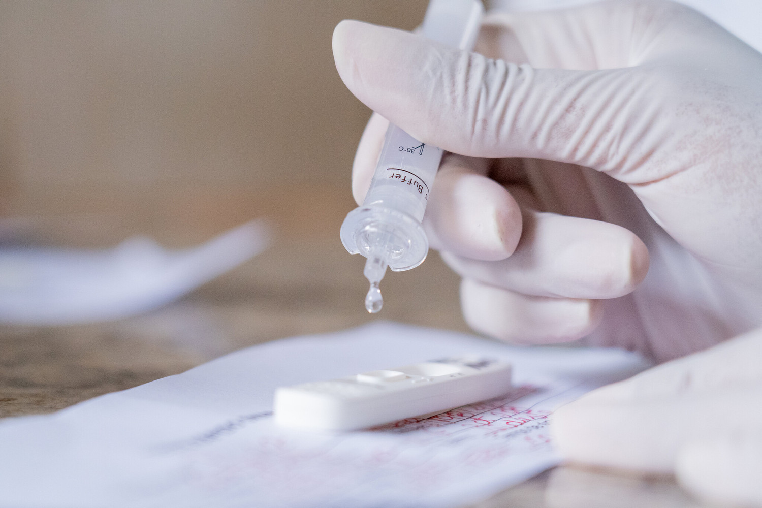 Teste rápido pode ser feito entre o 1º e o 7º dia de sintomas
