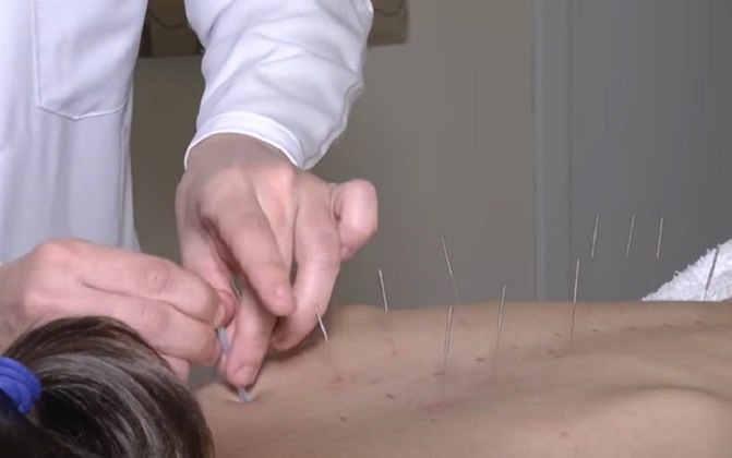 Muita gente nunca fez acupuntura, porém essa é uma das formas mais eficazes de melhorar a dor na região do pescoço. Além disso, a prática pode melhorar até mesmo o torcicolo.