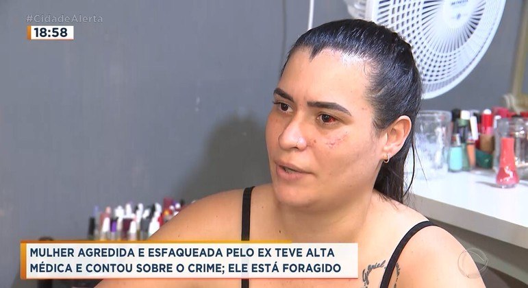 Mulher Agredida E Esfaqueada Pelo Ex Marido Em Santa Rosa De Viterbo Recebe Alta Médica