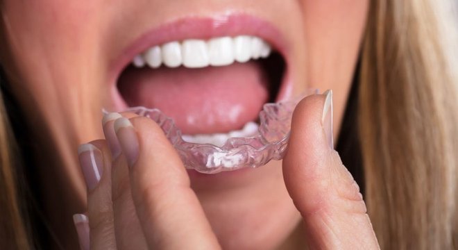 Formas leves de bruxismo são frequentes e podem ser contidas com protetores bucais