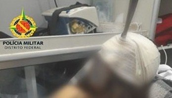 Mulher fica com faca cravada na cabeça após ser agredida por homem no Gama (Divulgação/PCDF - 31.03.2023)