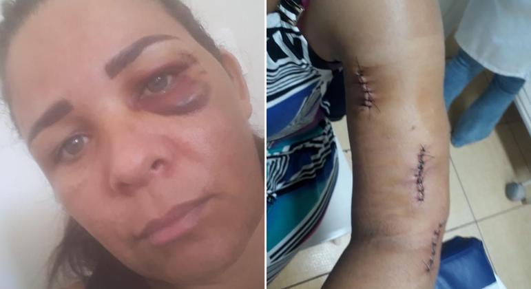 Mulher foi espancada dentro de padaria em SP após pedir para o cliente usar a máscara