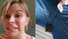 Mulher encontra morcego vivo aninhado entre as pernas 